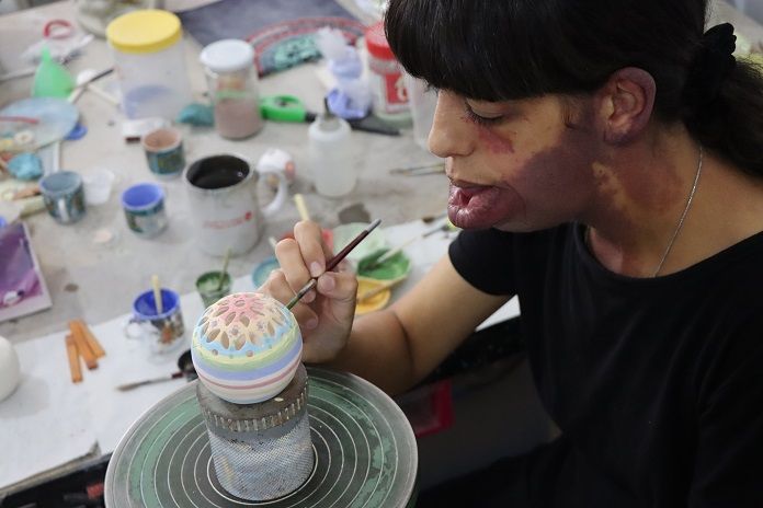 Un síndrome deforma la cara de Basma, pero con sus manos es buena creando bellas artesanías en Belén